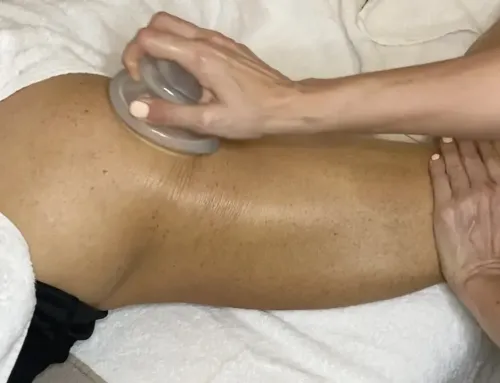 Cupping voor beginners bij cellulite